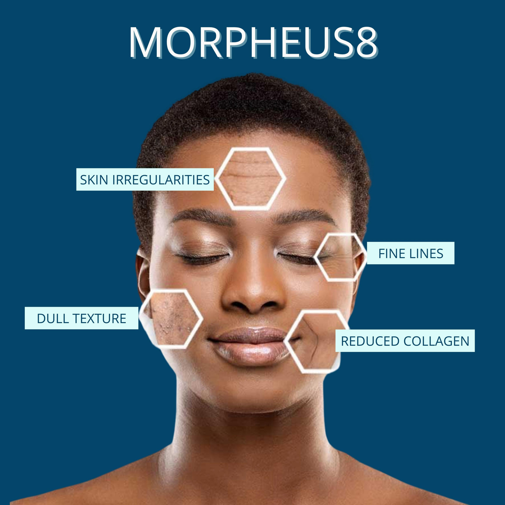 MORPHEUS8 SALE Feel Ideal 360 Med Spa Southlake TX