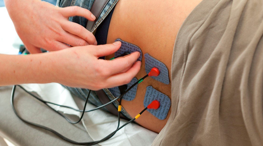 Electrical Stimulation Therapy - Chronic Conditions Center