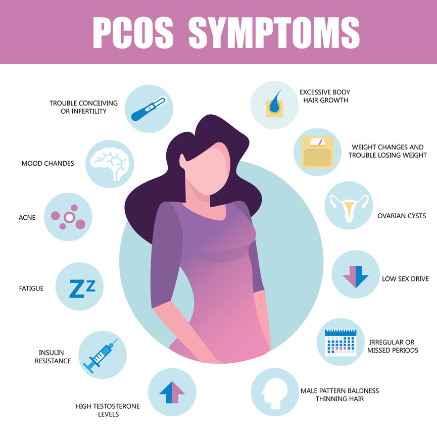 Polycystic Ovarian Syndrome PCOS Dr Joseph Leveno