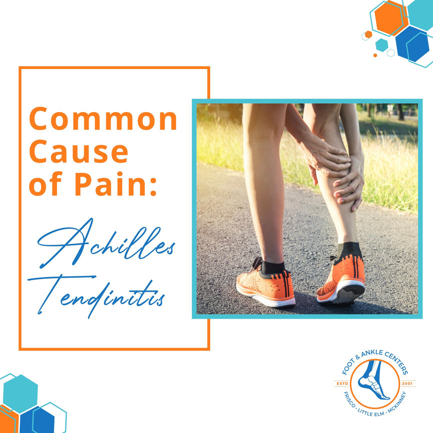 Common Cause of Pain: Achilles Tendinitis - Foot & Ankle Centers of ...