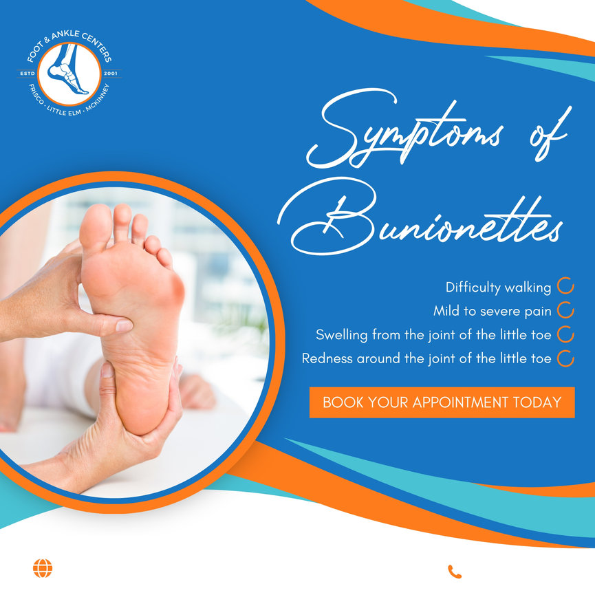 Understanding the Symptoms of Bunionettes in Frisco, Little Elm, and ...