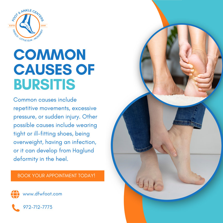 Common causes of bursitis in Frisco, Little Elm, and McKinney - Foot ...