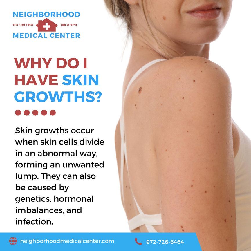 Skin Color Growth Why Do I Have Skin Growths and Treatment in Dallas, Texas ...