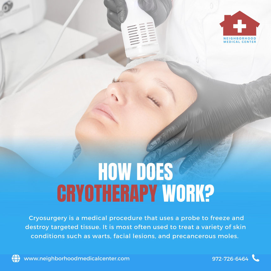 Cryotherapy Methods How Does Cryotherapy Work in Dallas, Texas - Neighborhood Medical Center