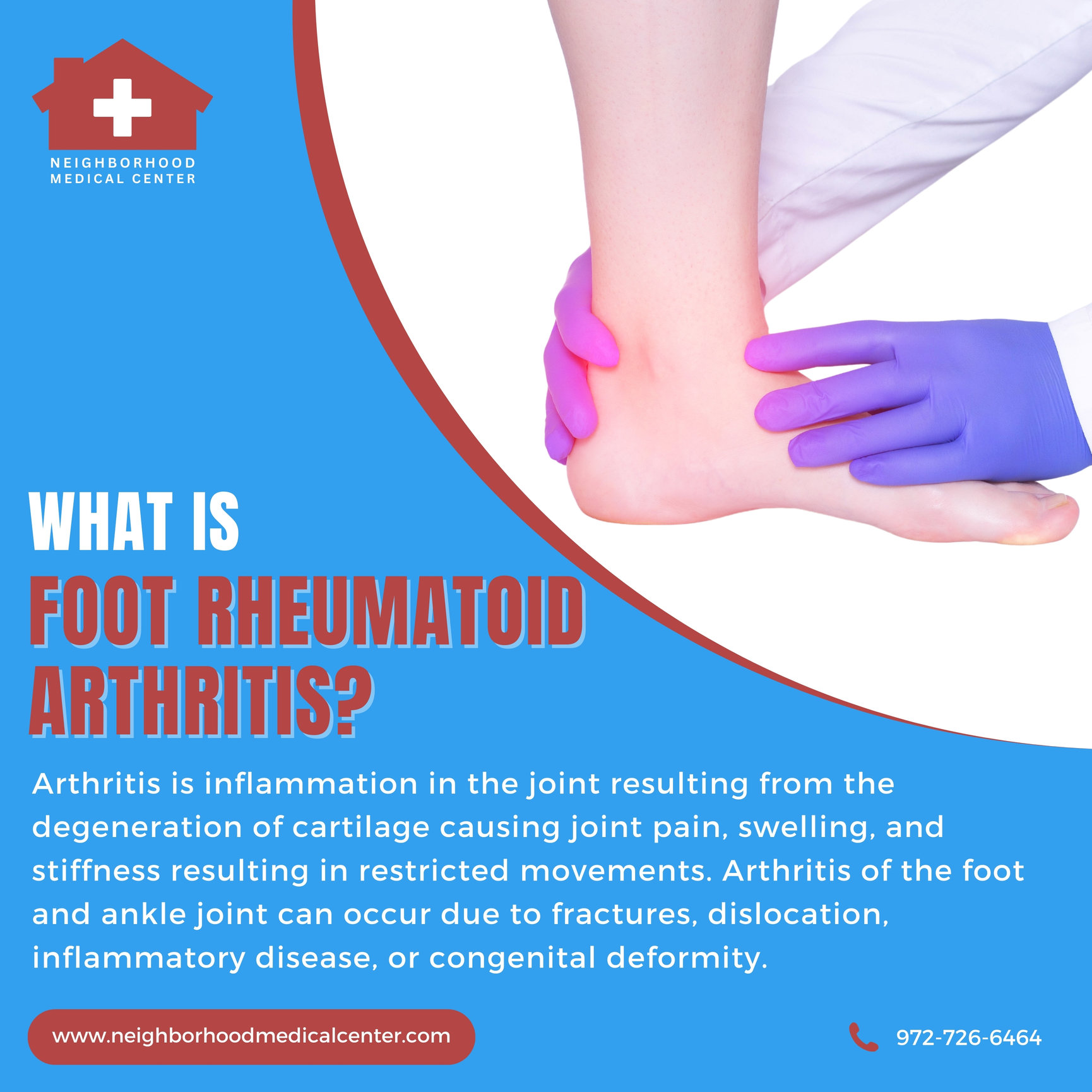 What Is Foot Rheumatoid Arthritis? Dallas, Texas Neighborhood Medical Center